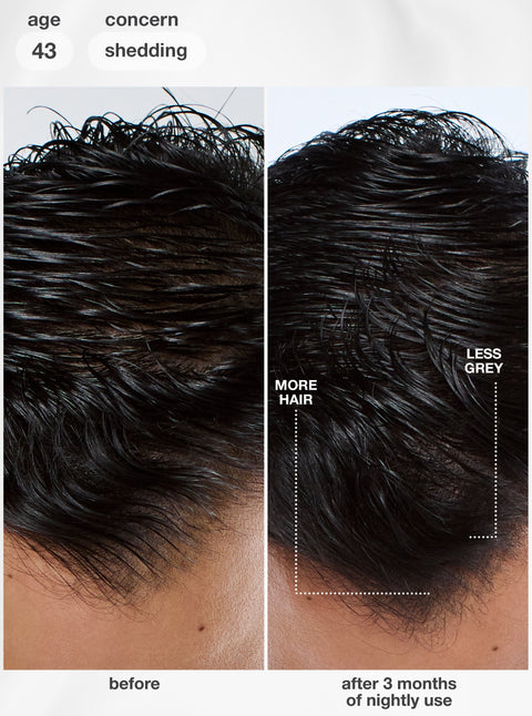 K18 FutureIQ before and after 3 months