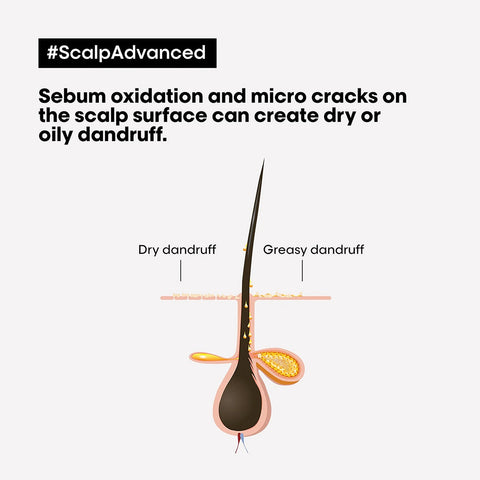 L'Oréal Professionnel Scalp Advanced Anti-Dandruff Shampoo 1500ml